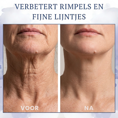 FIRMOZE™ | Verstevigende & Rimpel-verminderende Crème