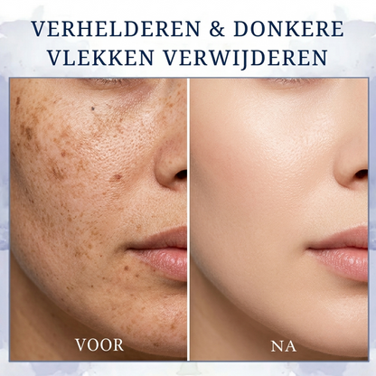 FIRMOZE™ | Verstevigende & Rimpel-verminderende Crème