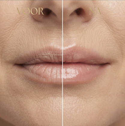 LipCare™ | Anti-aging Collageen Lippenbalsem