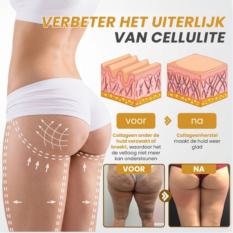 VenoFirm™ | Botox Rimpelverstevigende Crème