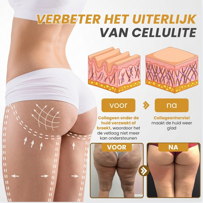 VenoFirm™ | Botox Rimpelverstevigende Crème
