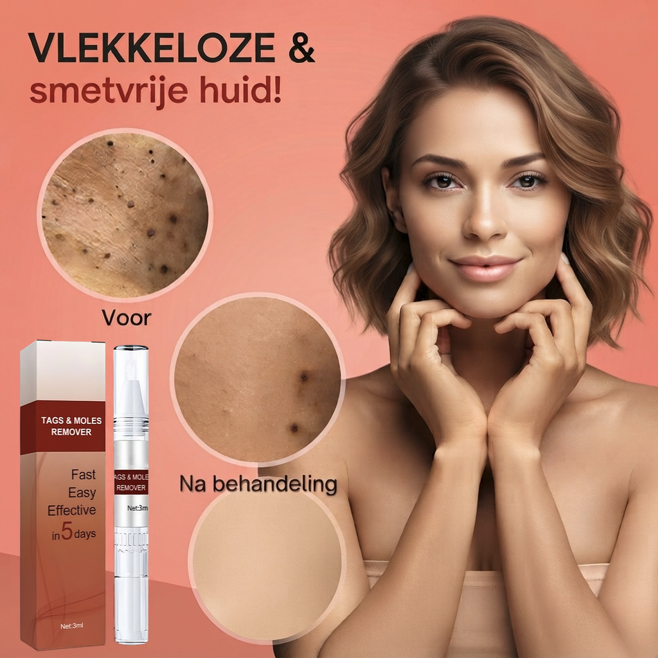 Tag Smooth™ | Huidtags en Moedervlekken Verwijderaar