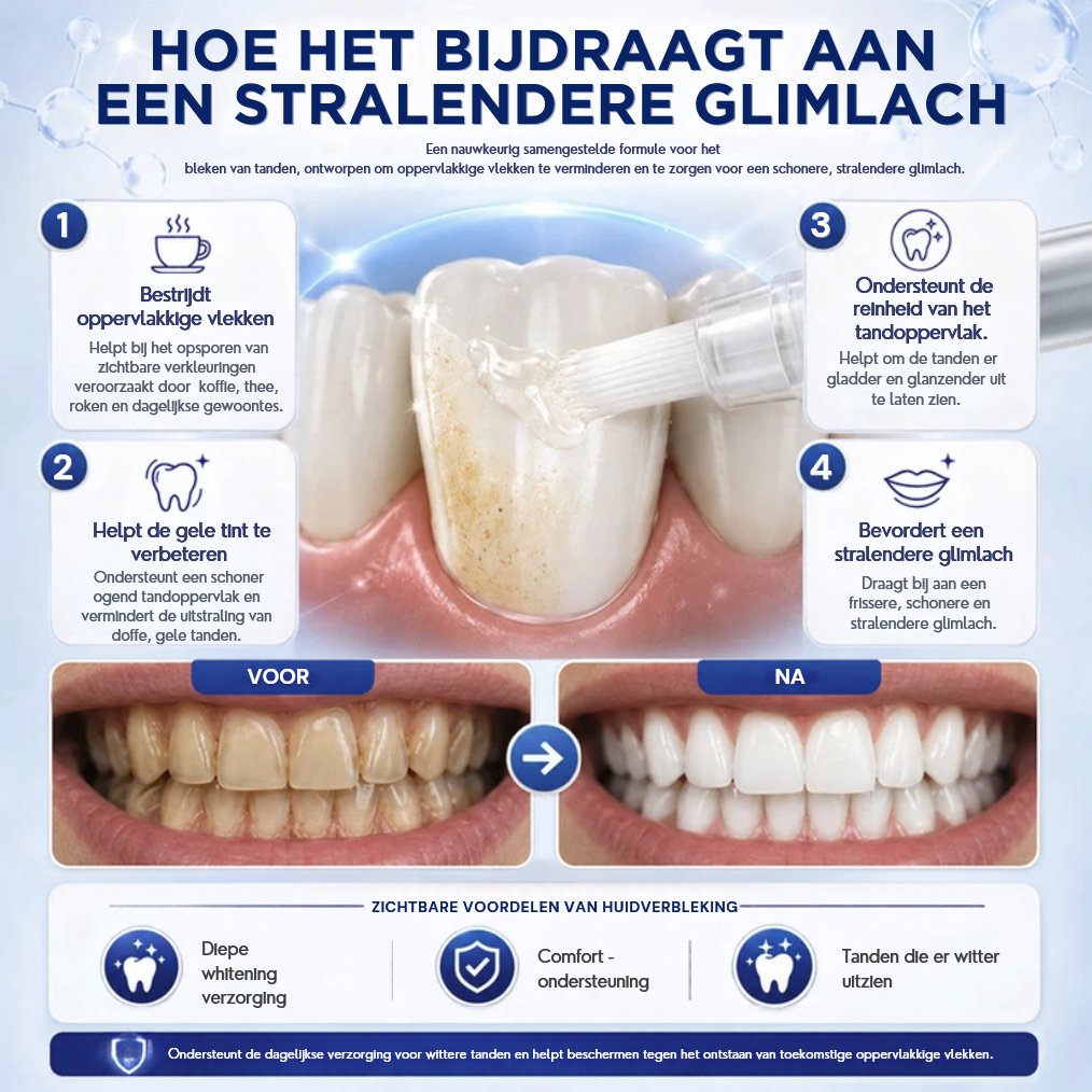 PearlWhite™ | Tandenwitmaakpen