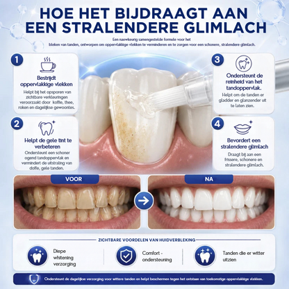 PearlWhite™ | Tandenwitmaakpen