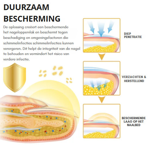 NailSoothe™ | Oplossing voor Schimmelnagels