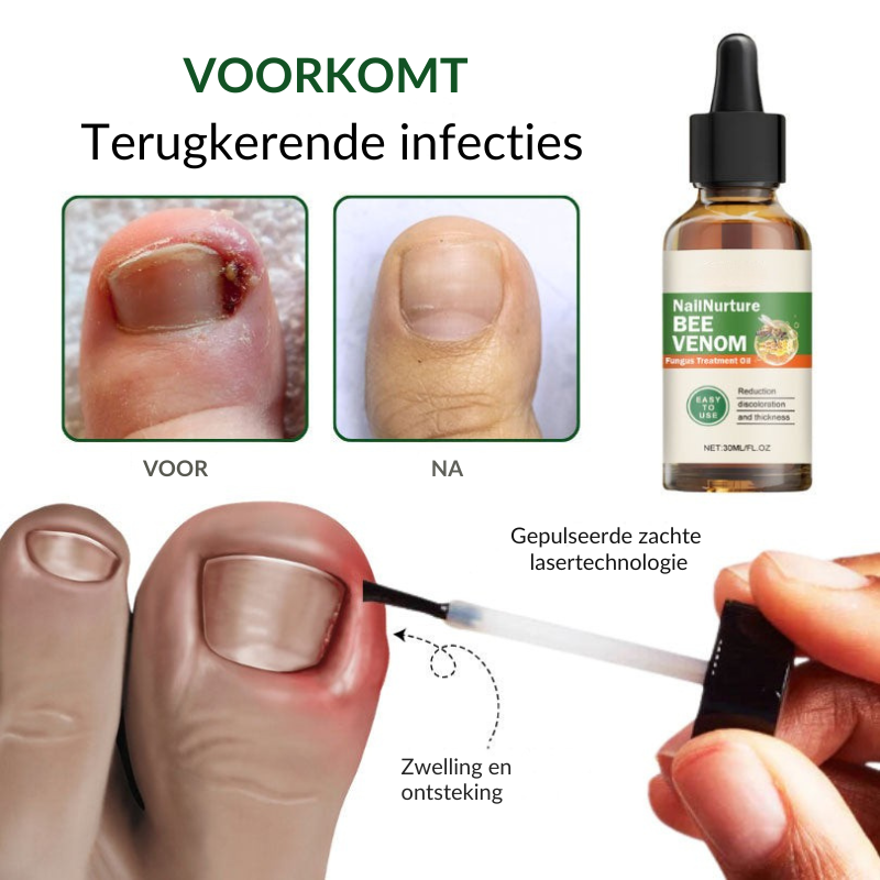 SCHIMIFYX™ | Schimmelbehandelolie