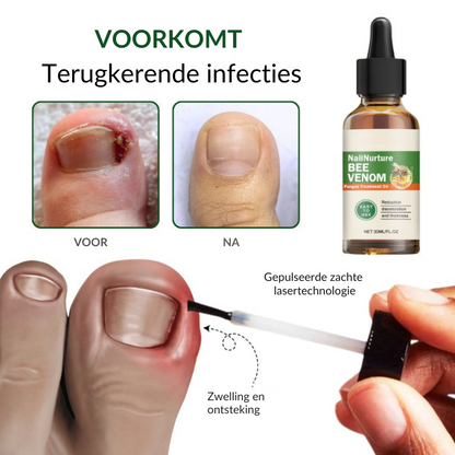 SCHIMIFYX™ | Schimmelbehandelolie