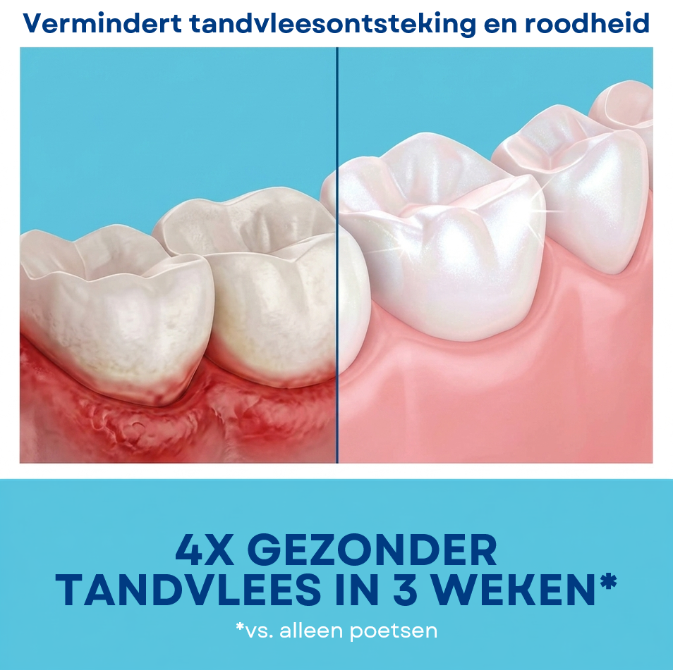 Teeth Foam™ | Tanden Bleken Mousse