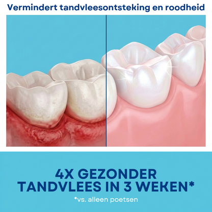 Teeth Foam™ | Tanden Bleken Mousse