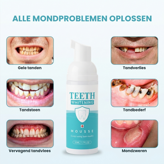 Teeth Foam™ | Tanden Bleken Mousse