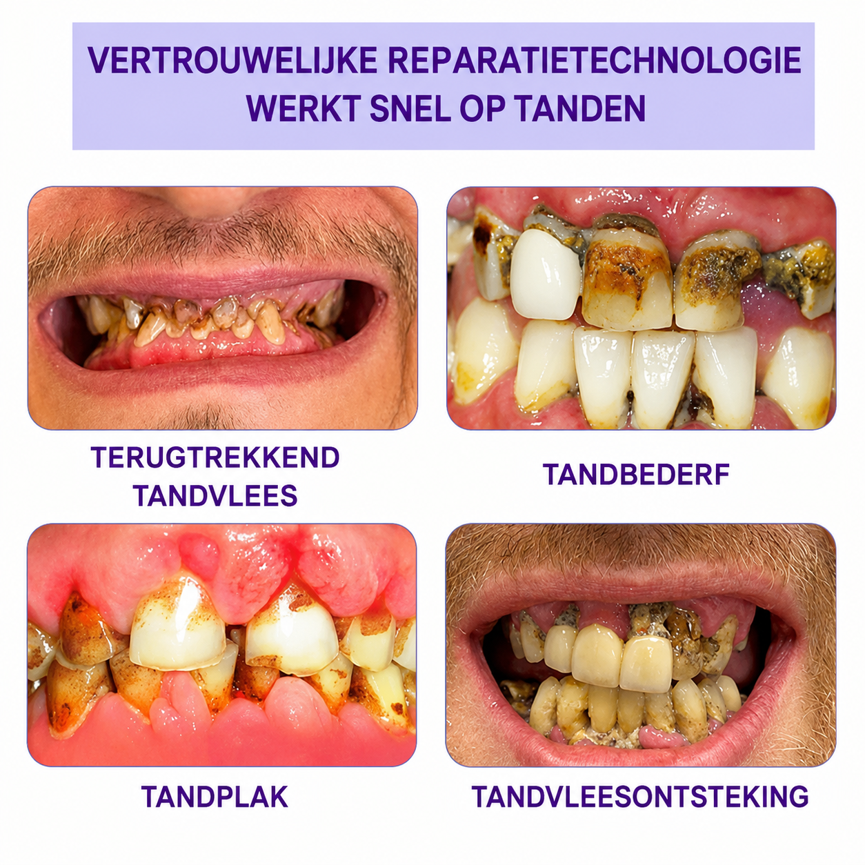 ToothBloom™ | Tanden Restauratie Mineraal Poeder