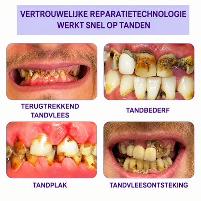 ToothBloom™ | Tanden Restauratie Mineraal Poeder