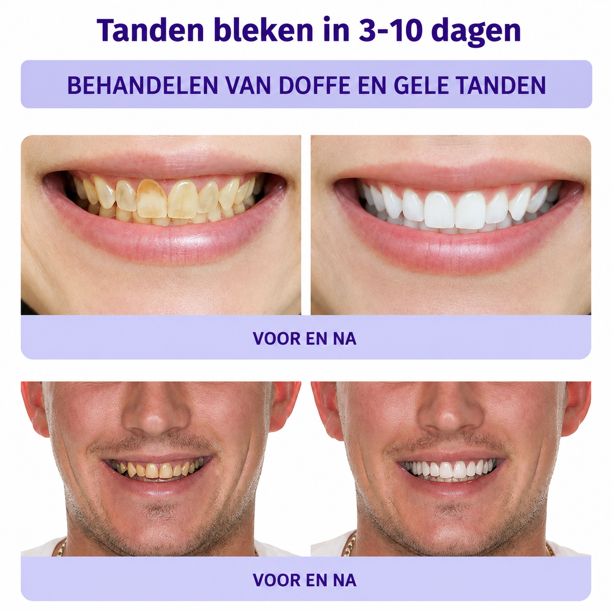 ToothBloom™ | Tanden Restauratie Mineraal Poeder