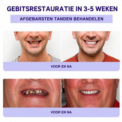 ToothBloom™ | Tanden Restauratie Mineraal Poeder