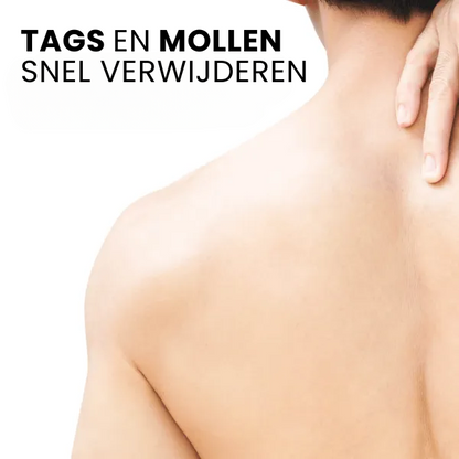 SpotGone™ | Bijengif Moedervlek- en Wrattenbehandeling Crème