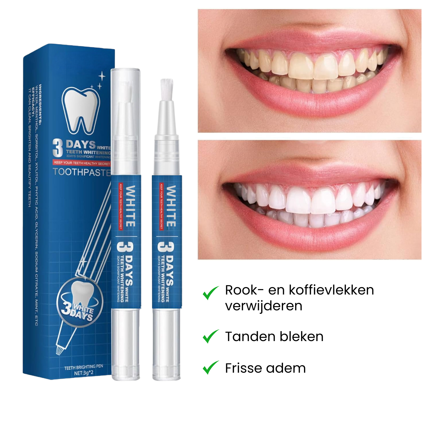 tanden bleken
tandenbleken
tanden witter maken
tanden bleachen
wittere tanden
tanden laten bleken
tanden bleachen prijs
tanden bleken prijs
bleaching tanden prijs
bleachen tanden