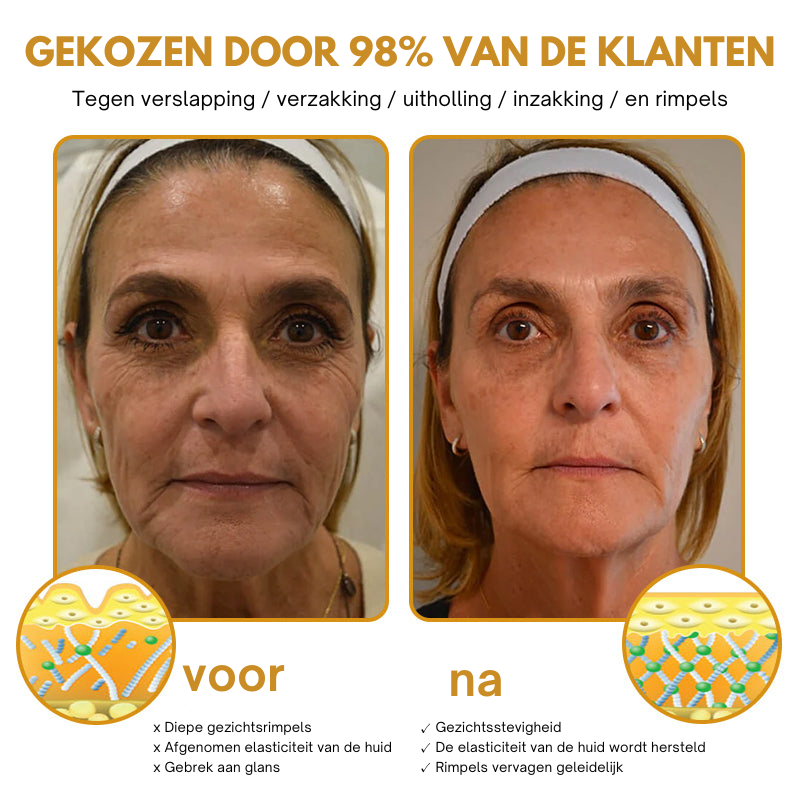 Anti-Wrinkle™ | Botox Rimpelverwijdering Crème