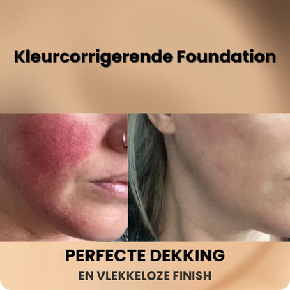 SKEENTION™ | Kleurcorrigerende Foundation