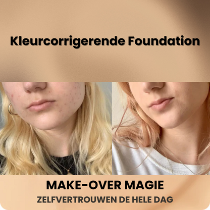 SKEENTION™ | Kleurcorrigerende Foundation