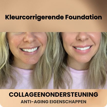 SKEENTION™ | Kleurcorrigerende Foundation