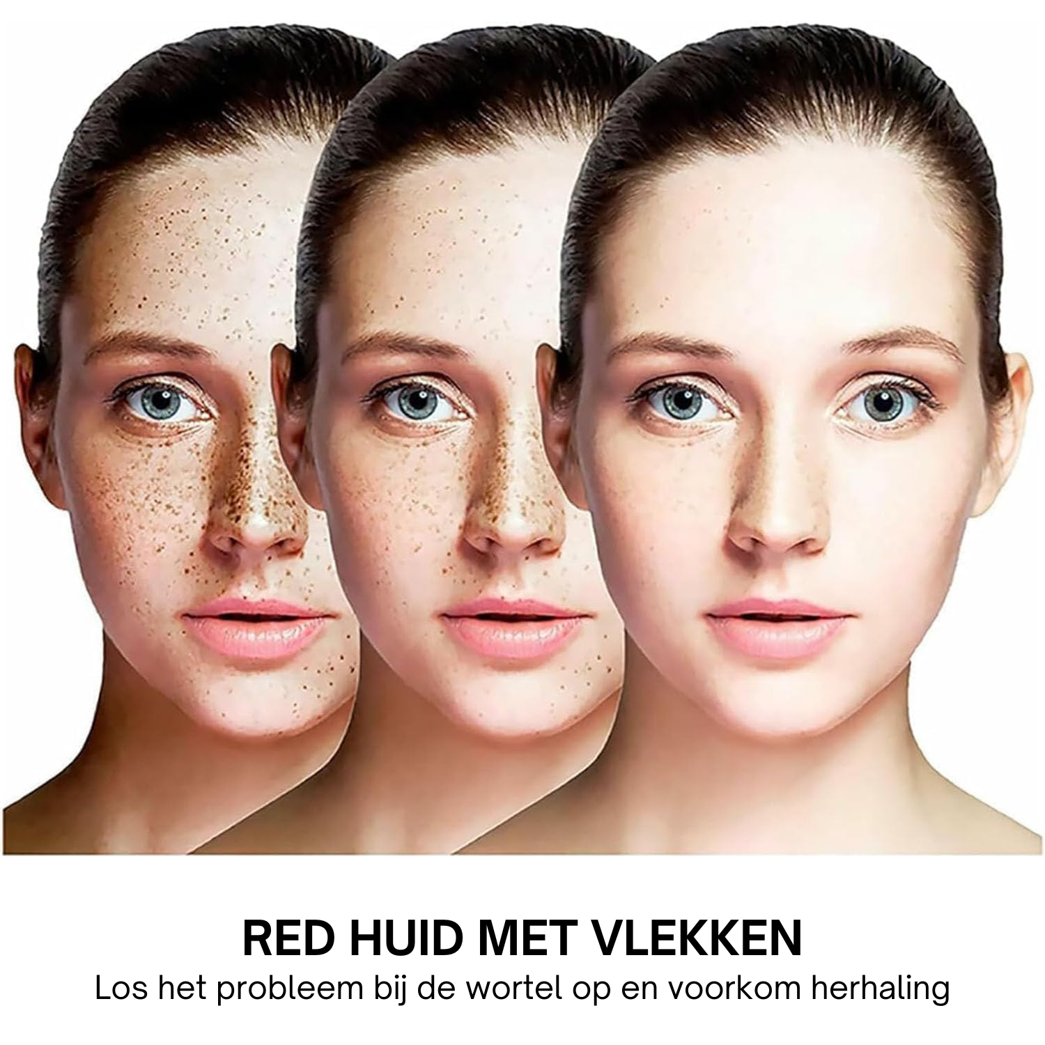 Spotless Reveal™ | Huidverhelderend Serum