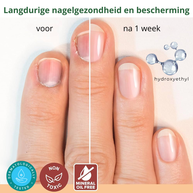 SCHIMIFYX™ | Schimmelbehandelolie