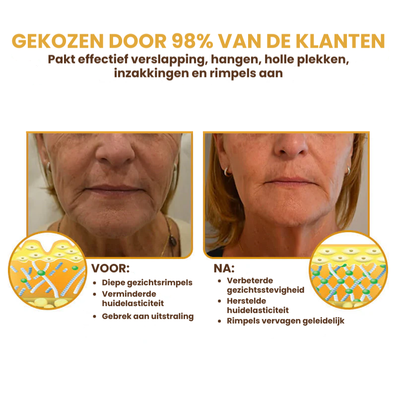 LIFFTAVIA™ | Huidverstevigende Crème