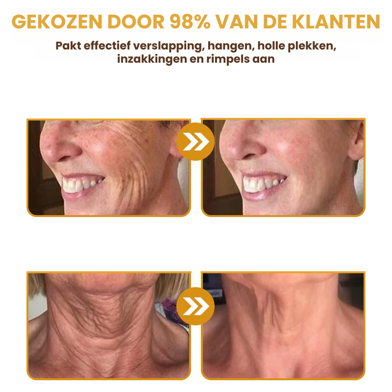 LIFFTAVIA™ | Huidverstevigende Crème