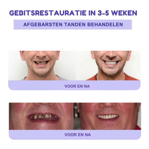 ToothBloom™ | Tanden Restauratie Mineraal Poeder
