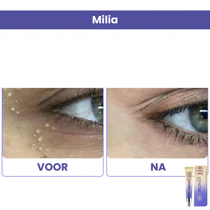 SEROLLIS™ | Verstevigende Oogcrème