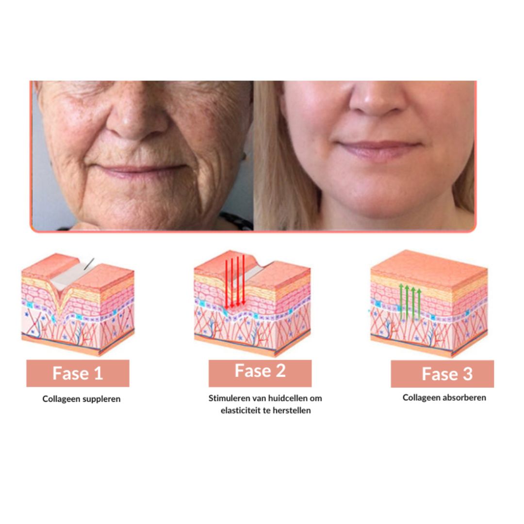 CollaFortify™ | Collageen Jelly Crème