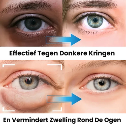 DewLisse™ | Collageen Oogcrème