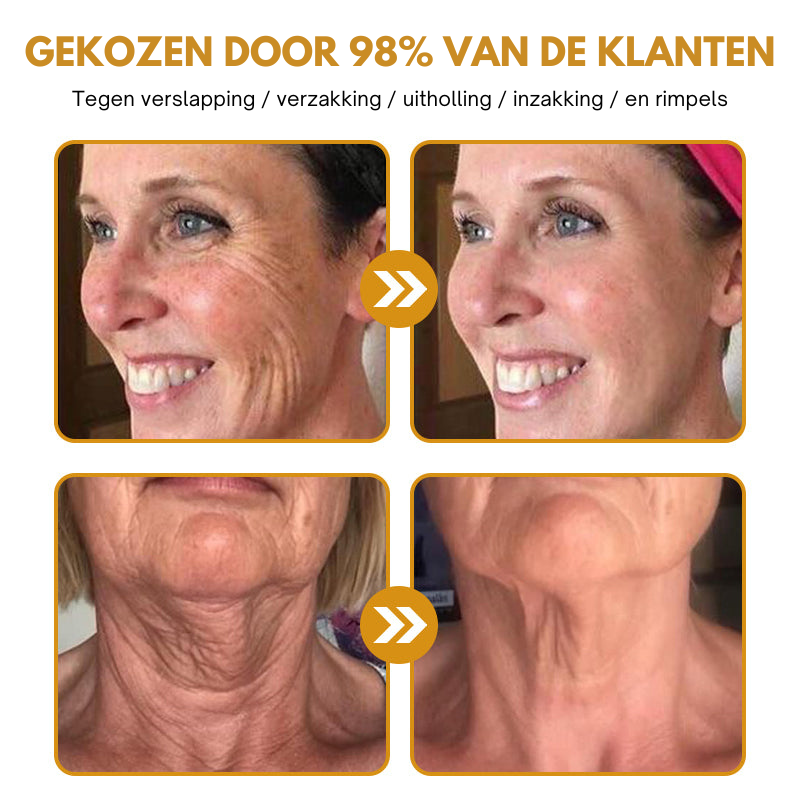 Anti-Wrinkle™ | Botox Rimpelverwijdering Crème