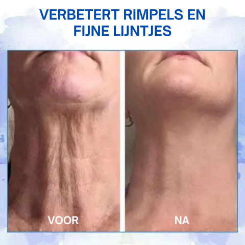 RevytaFirm™ | Ultra Verstevigende en Revitaliserende Crème