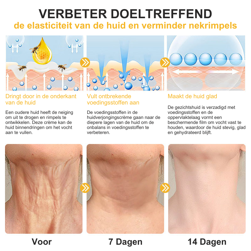 LiftedSkin™ | Anti-Aging Verstevigende Crème