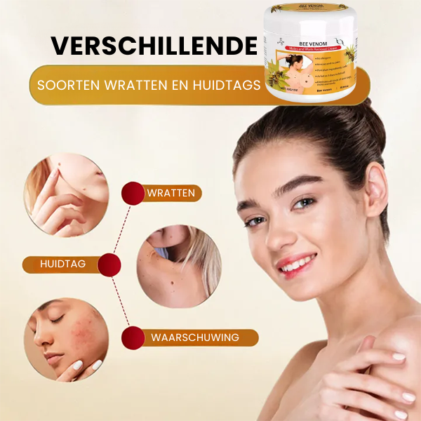 SpotGone™ | Moedervlek- en Wrattenbehandeling Crème