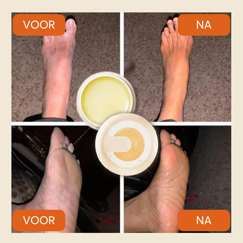 NOURISA™ | Droge en Schrale Huid Crème