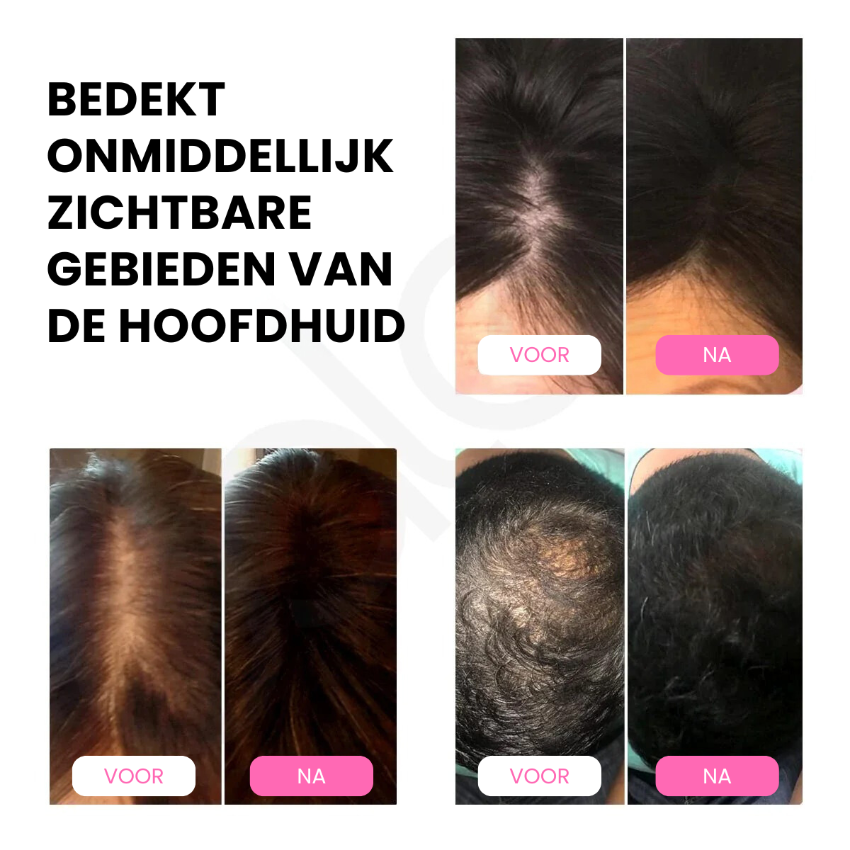 SHADEA™ | Haarkleur Stempel