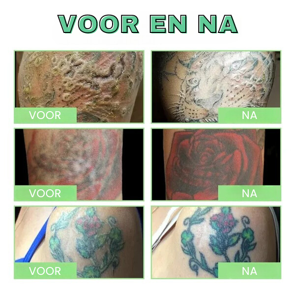 AELIXO™ | Tatoeage Verhelderende Nazorg Balsem