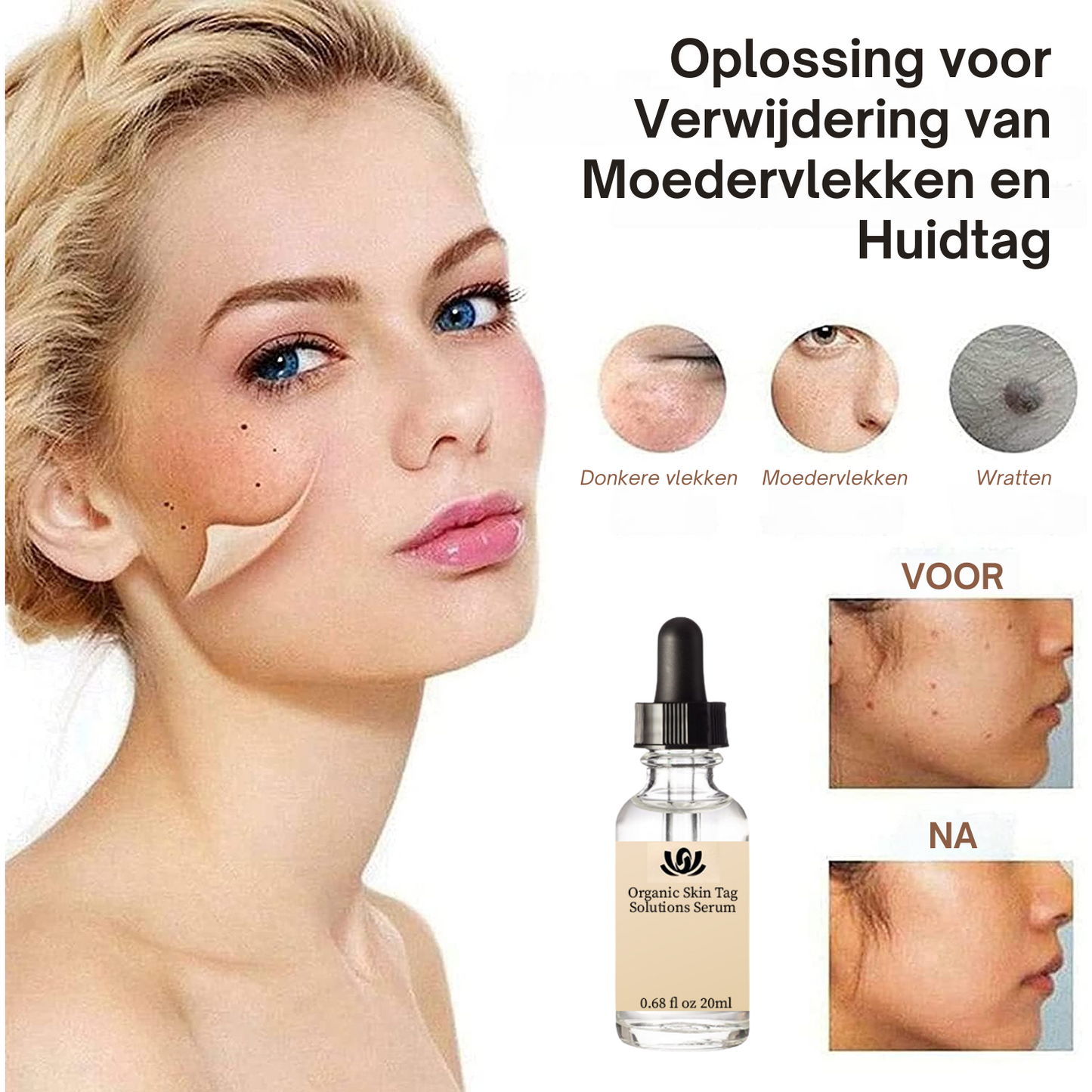 Spotless Skin™ | Biologisch Huidtagoplossingen Serum