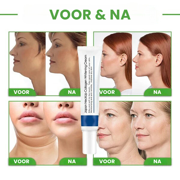 RejuvaNeck™ | Collageen Nek Crème