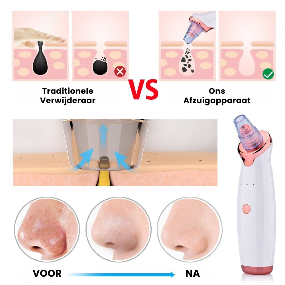 FreshPore™ | Poriënvacuüm en Mee-eters Verwijderaar