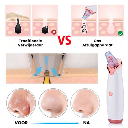 FreshPore™ | Poriënvacuüm en Mee-eters Verwijderaar