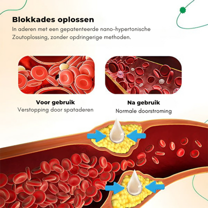 VeinRevive™ | Spataderen Herstel Crème