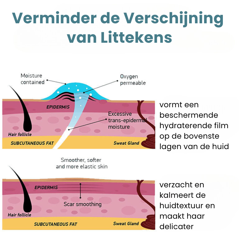 RejuvScars™ | Littekenverwijderings Gel