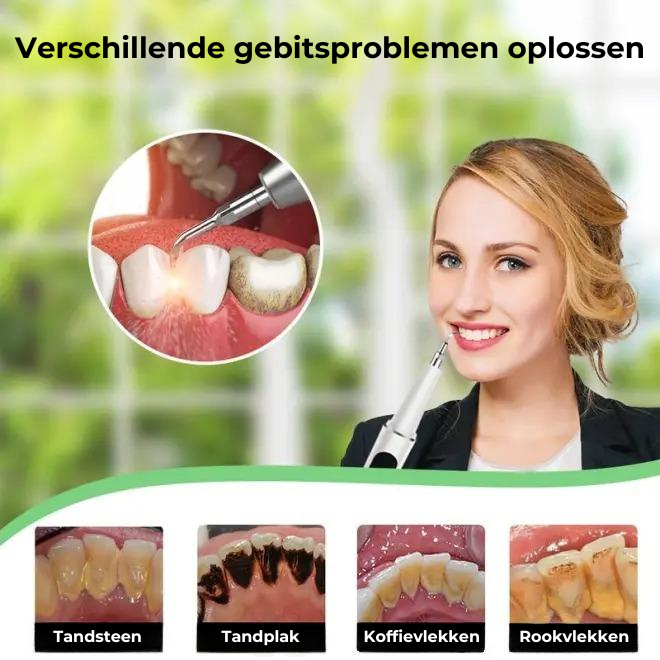 TARTYZE™ | Ultrasone Elektrische Tandenreiniger