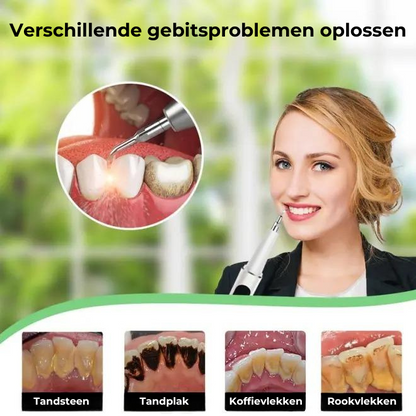 TARTYZE™ | Ultrasone Elektrische Tandenreiniger