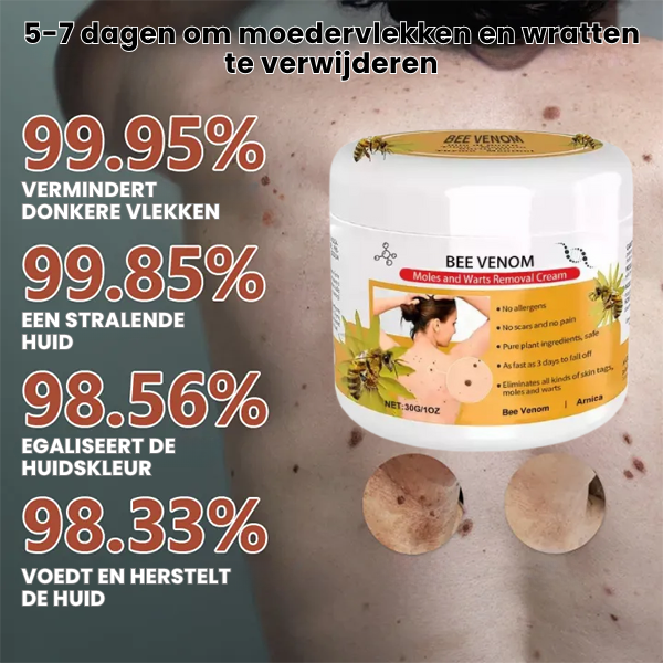 SpotGone™ | Moedervlek- en Wrattenbehandeling Crème