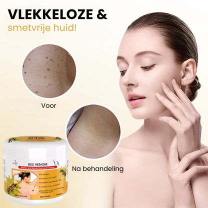 SpotGone™ | Moedervlek- en Wrattenbehandeling Crème