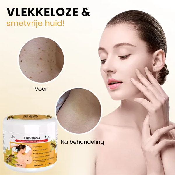 SpotGone™ | Moedervlek- en Wrattenbehandeling Crème